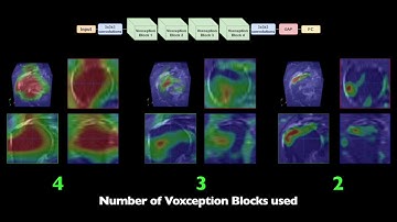 3D Visualization of Deep Learning for Medical Image Diagnosis