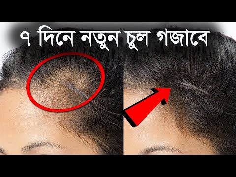 ভিডিও: এক্রাইলিক নখ দূর করার W টি উপায়