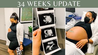 34 Week Ultrasound Appointment | Pregnancy Update