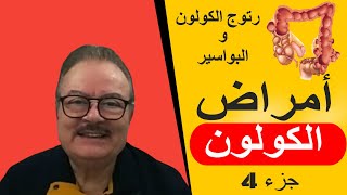 رتوج الكولون والبواسير