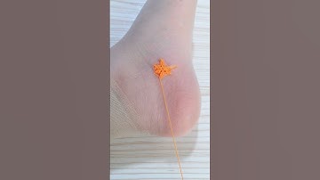 Learn to Fix Hole in Sock Part 3083 #shorts