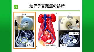 子宮頸がん・子宮体がんの検査・診断