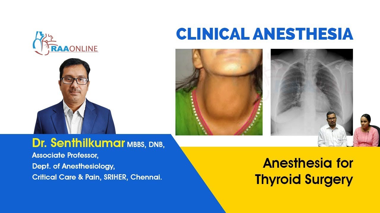 Anesthesia for Thyroid Surgery YouTube