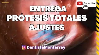 AJUSTES a la hora de Entregar 👅 Una PRÓTESIS DENTAL