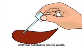 Hoe De Ifob-Test Gebruiken?