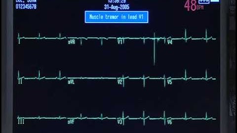 MAC 5500 Training Video (Part 2)