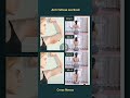Arm fatloss workout at home no gym needed #workout #abs #weightloss #fitness
