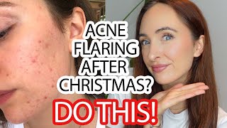 ACNE FLARE UP After Christmas? DO THIS! // Acne Nutritionist&#39;s Tips