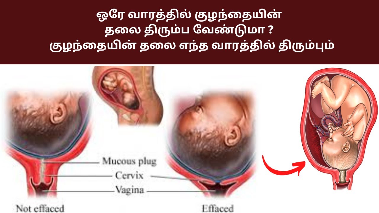 head down position symptoms in tamil Baby head down position symptoms