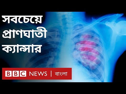 ভিডিও: সবচেয়ে নরম ফুসফুস