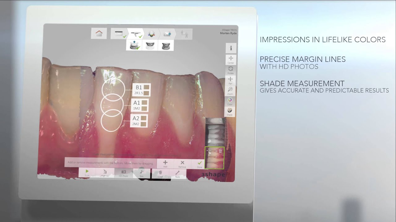 3Shape on TRIOS 3 - YouTube