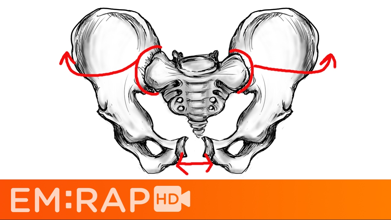 Reconstruction of Pelvic Fracture Urethral Injury | Plastic Surgery Key