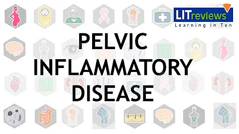 Pelvic Inflammatory Disease - DayDayNews