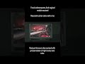Redo Endometriosis Surgery Performed by Dr. Chetan Patel at Sparsh Women’s Hospital