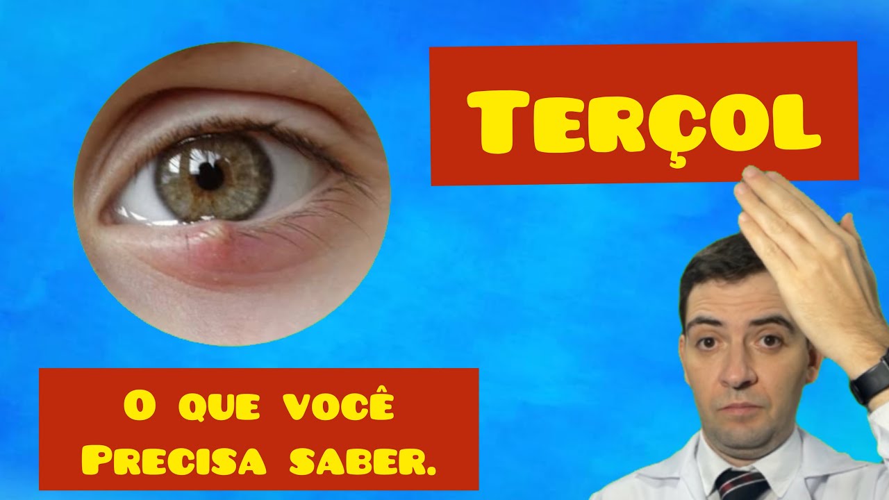 Hordéolo e Terçol: o que é, sintomas e tratamento - Dr. Gustavo