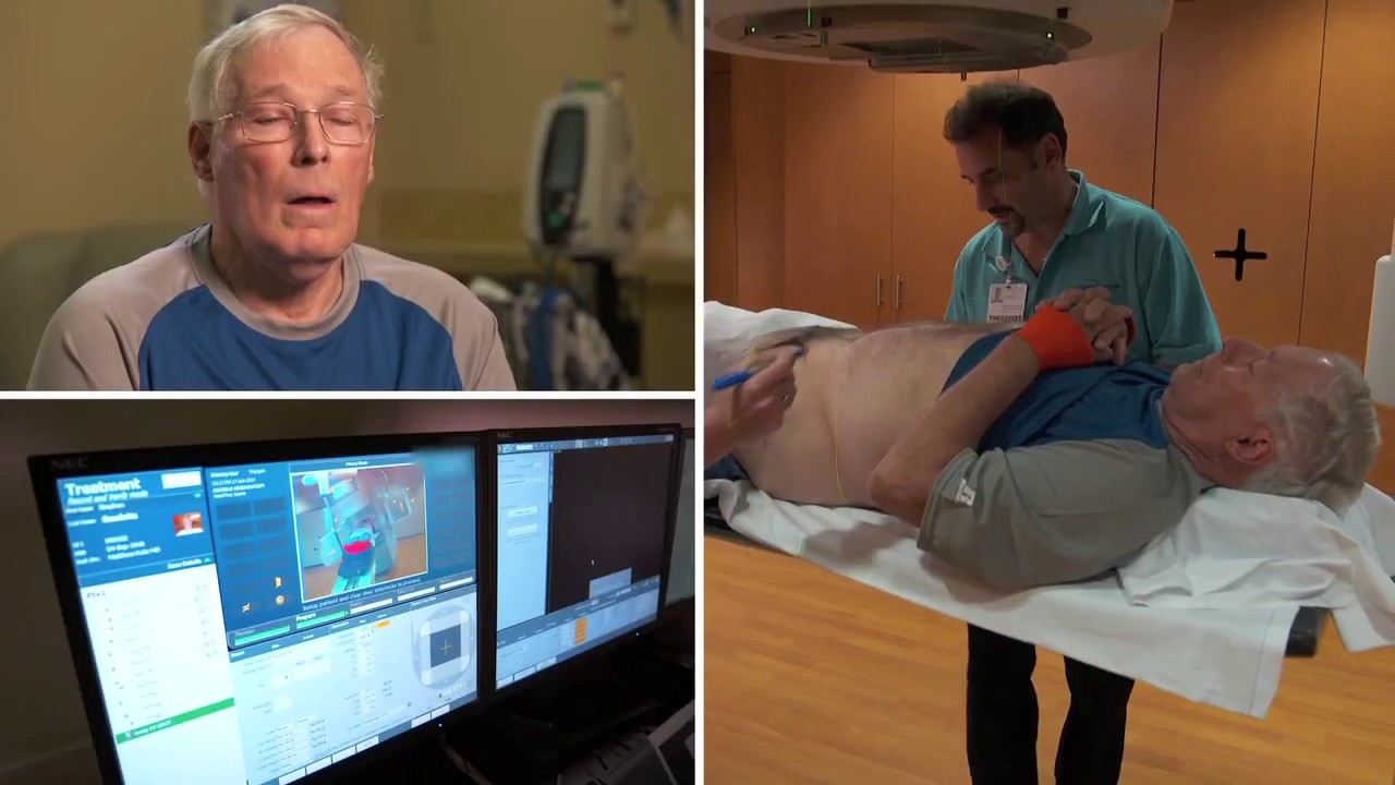 Radiation Therapy for Prostate Cancer YouTube
