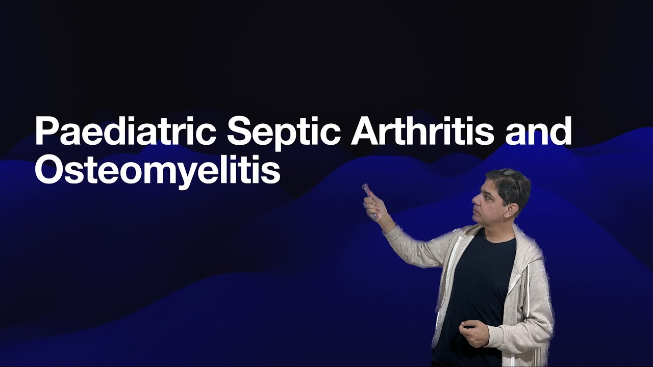 Paediatric Septic Arthritis and Osteomyelitis YouTube