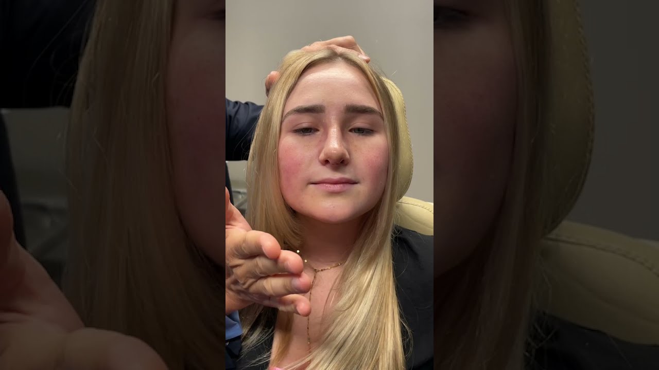 Top Facial Plastic Surgeon Dramatically Improves Facial Profile With Nose Surgery