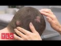 Brandon Has Bumps All Over His Head | Dr. Pimple Popper