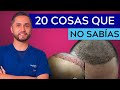 😱🇲🇽🔝INJERTO de CABELLO en MÉXICO | 20 Cosas que no SABÍAS