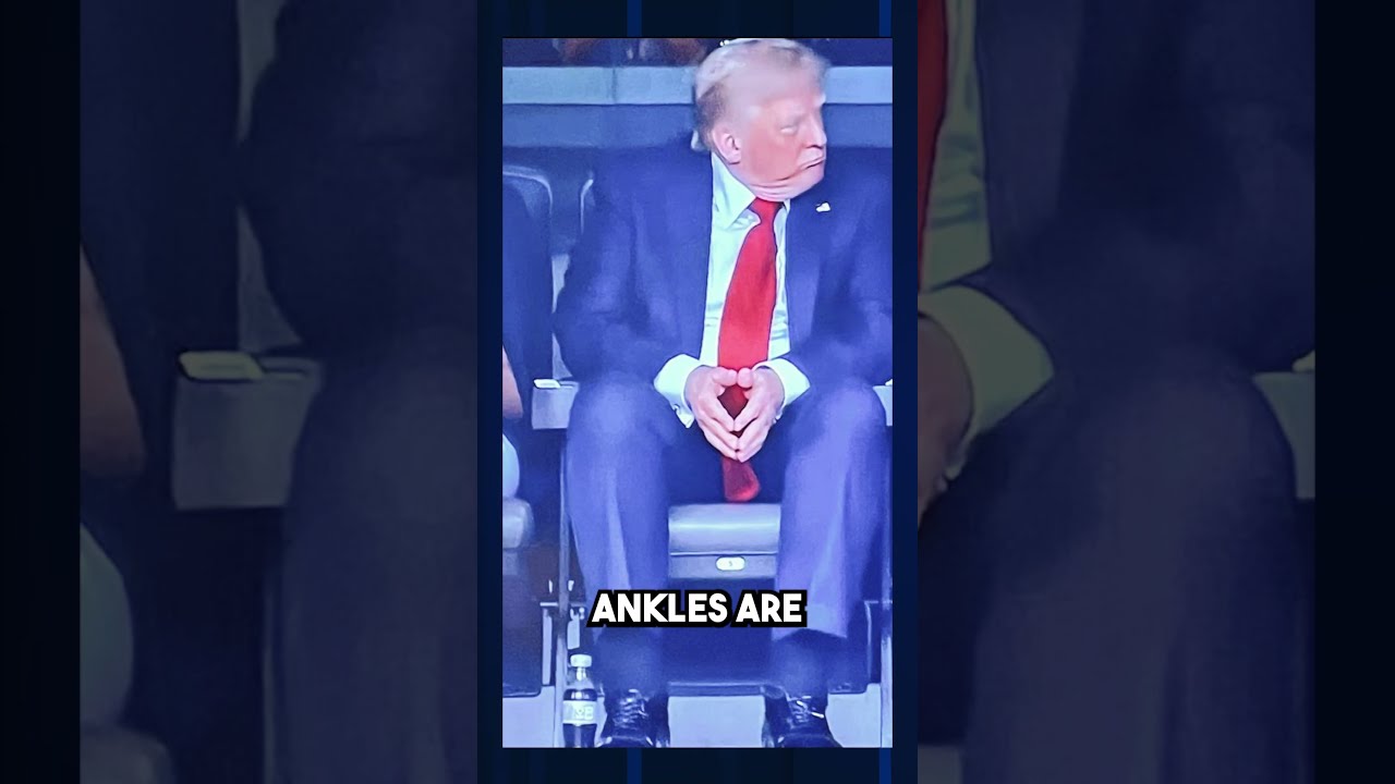 Trump Health Fears EXPLODE Over Swollen Ankles MORE Bruises Shorts