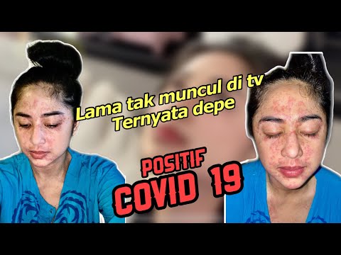 DERMATIX VS MEDERMA | Cara Menghilangkan Scar Bekas Jerawat Tanpa Perlu Ke Dokter | How I got rid my. 