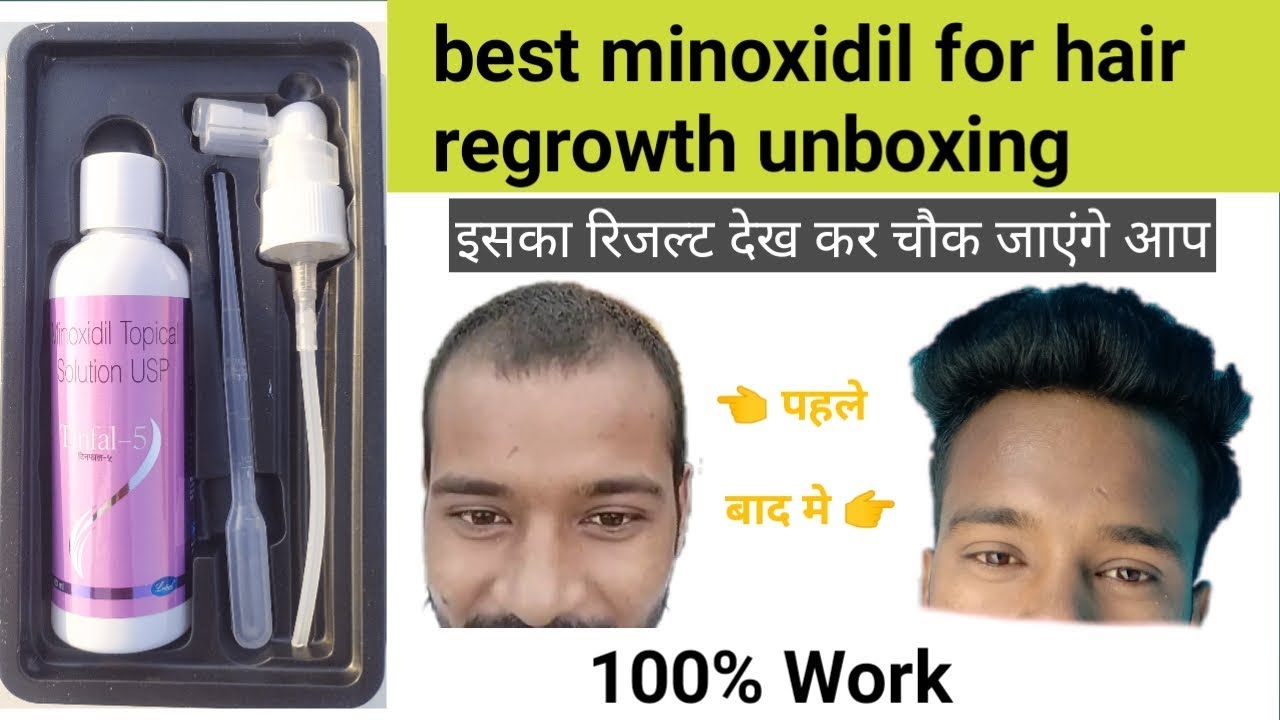 is minoxidil harmful for hair