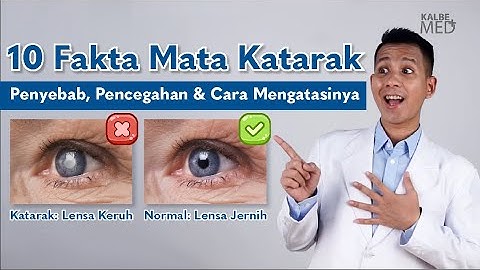 10 Fakta Mata Katarak: Penyebab, Pencegahan, dan Cara Mengatasinya