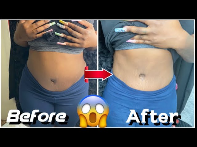 FLAT STOMACH in 30 Minutes l MY LIPO CAVITATION EXPERIENCE AFTER