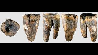A Neanderthal Had a Tooth Drilled 59,000 Years Ago. The Evidence Is Still in the Tooth. screenshot 4