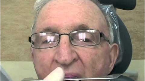 24 Occlusal Vertical Dimension