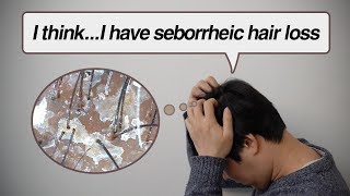 I think I have seborrheic hair loss
