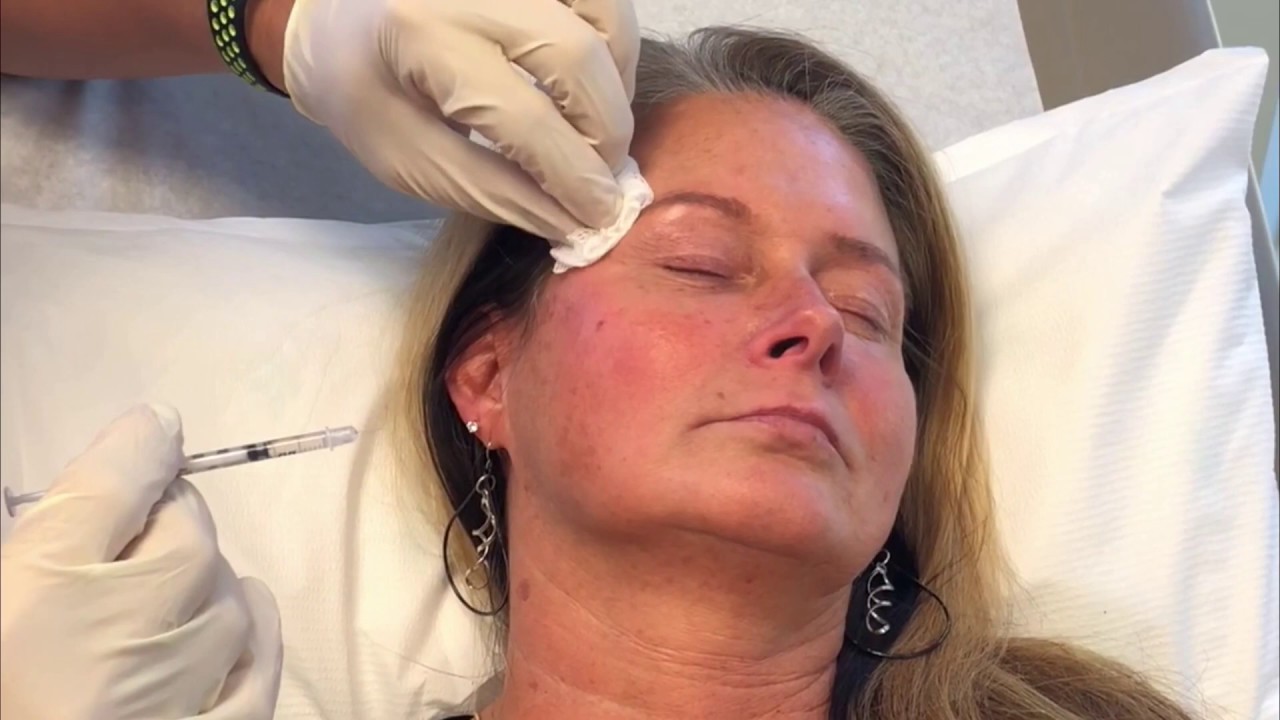 Dr. Chen Dysport® TouchUp YouTube