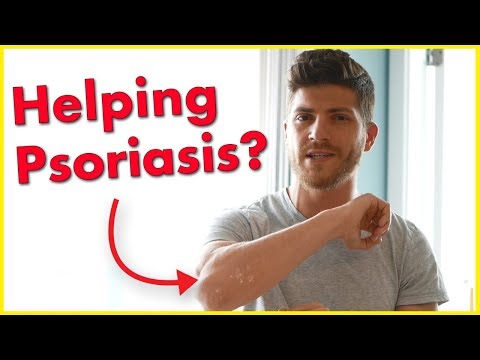 psoriasis-treatment-with-this-helped-ease-the-digestive-system