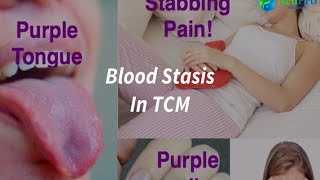 Blood Stasis in TCM