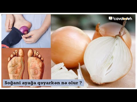 Video: Suvorovun Soğanı (18 şəkil): Böyüyən Soğan Və Sarımsaq Və Onun Təsviri. Ayrılmağın Nüansları. Nə Vaxt əkmək Lazımdır?