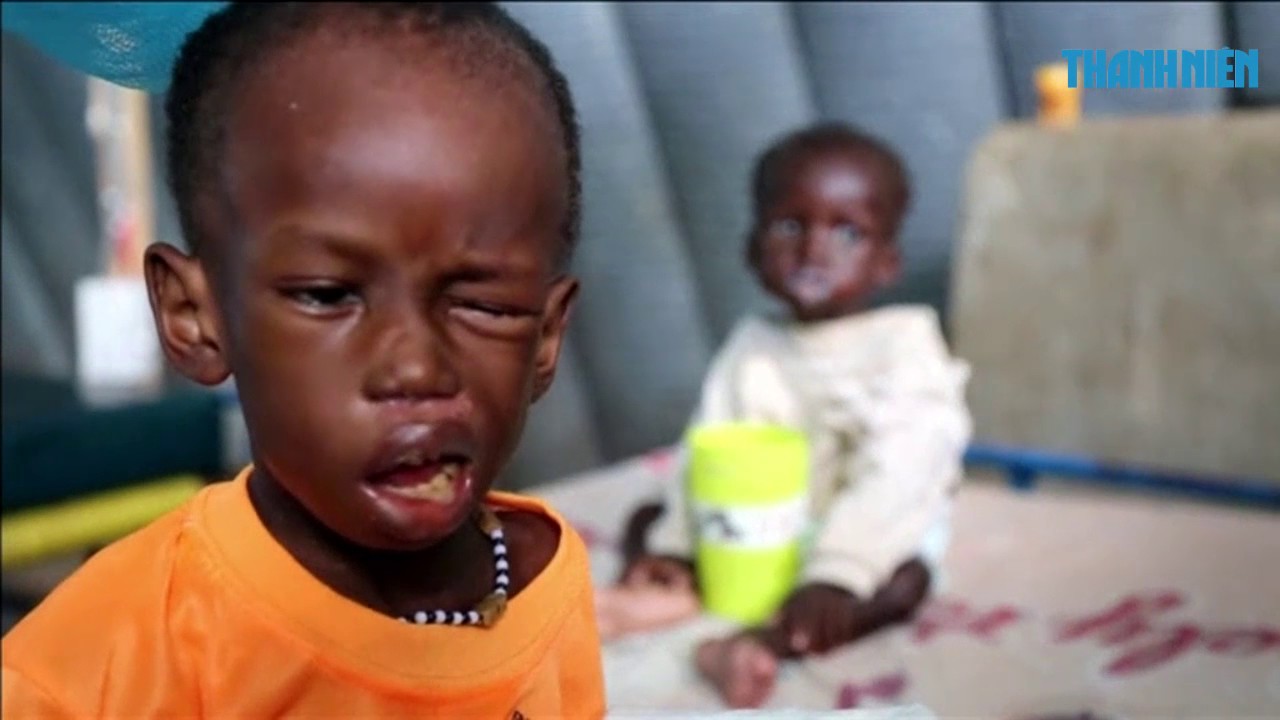 1,4 triệu trẻ em có nguy cơ chết đói - YouTube