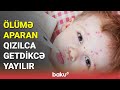 Qızılcanın sürətlə artma səbəbi açıqlandı