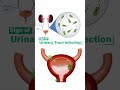 UTI in Women Don't ignore the signs!
