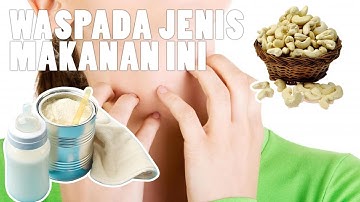 Alergi Makanan Ini Sering Terjadi, Kenali Gejalanya!