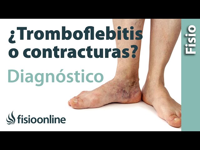 fisiopatología de la tromboflebitis superficial