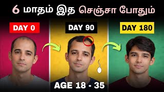 100% Reverse Your Hair Loss Naturally Fast வழகள Regrow Hair தமழல