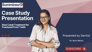 Root Canal Treatment for Fractured Front Teeth | Case Study by Dr. Sachi Mehta