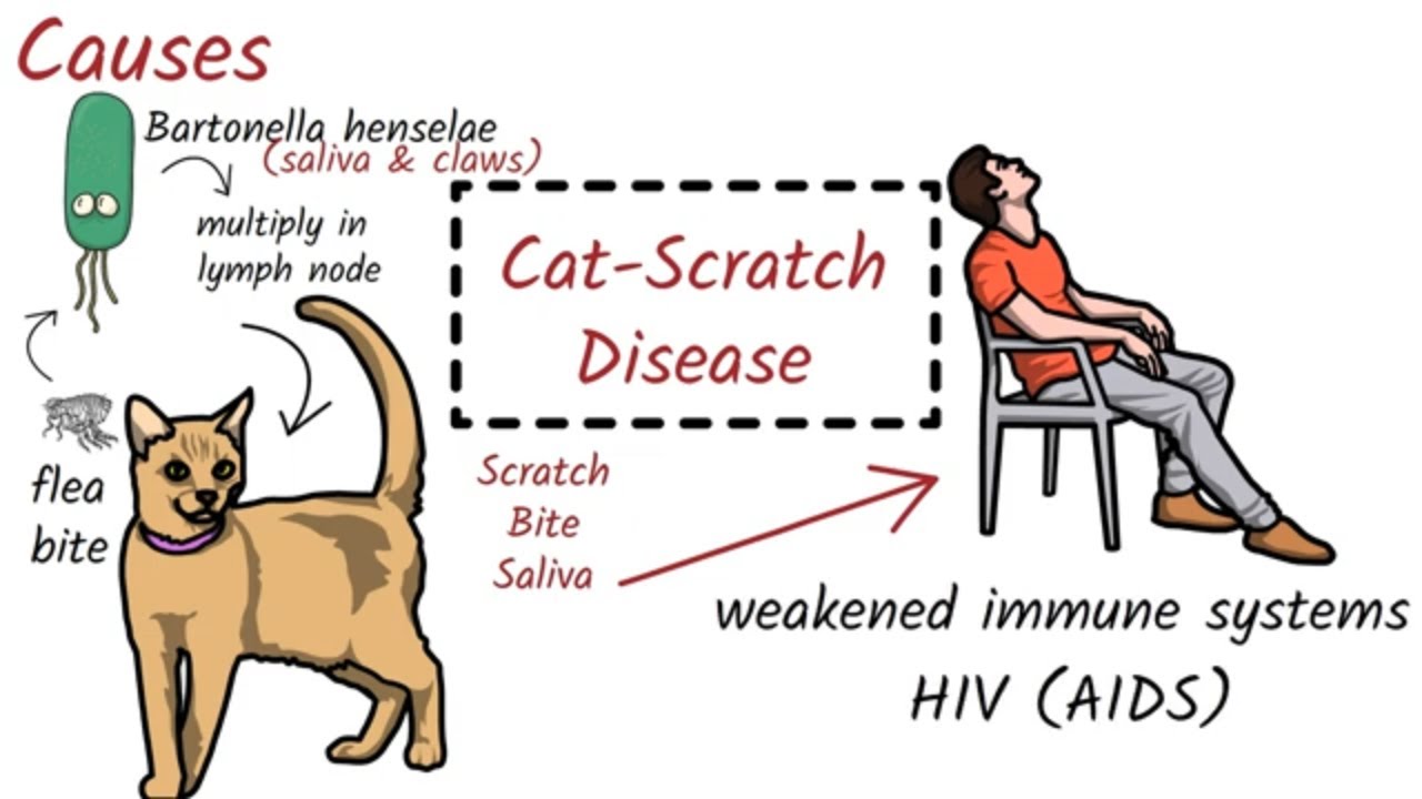 Cat Scratch Disease Causes Symptoms Diagnosis Treatmen Prevention