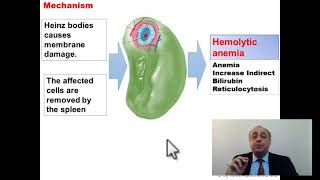 G6PD Deficiency [Favism]   #cme #internal_medicine #medical #usmle #محاضرات_باطنة #USMLE screenshot 2