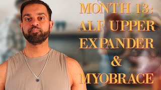 Month 13 TREATMENT COMPLETED: ALF Upper Expander Myobrace [My Orthotropics & Mewing Journey]