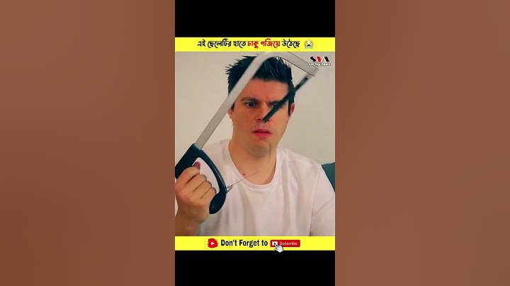 The boy's fingers turned into knives 😱 #shorts #ytshorts
