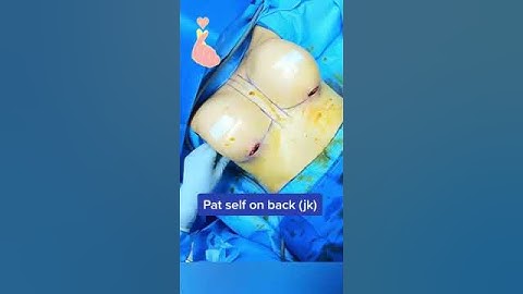 Breast implant insertion #shorts