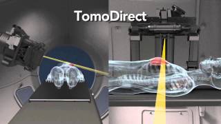 TomoTherapy H Movie