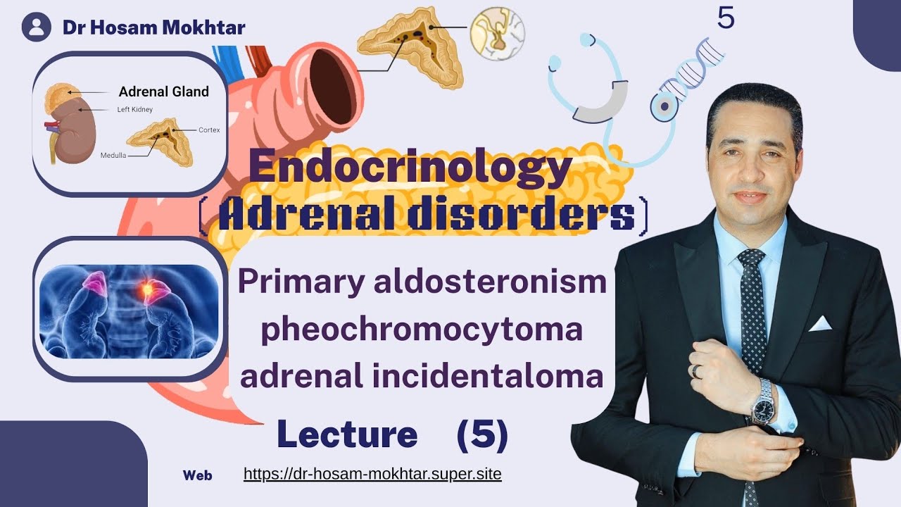 Endocrinology - Lecture 5 - Primary aldosteronism & pheochromocytoma & adrenal incidentaloma